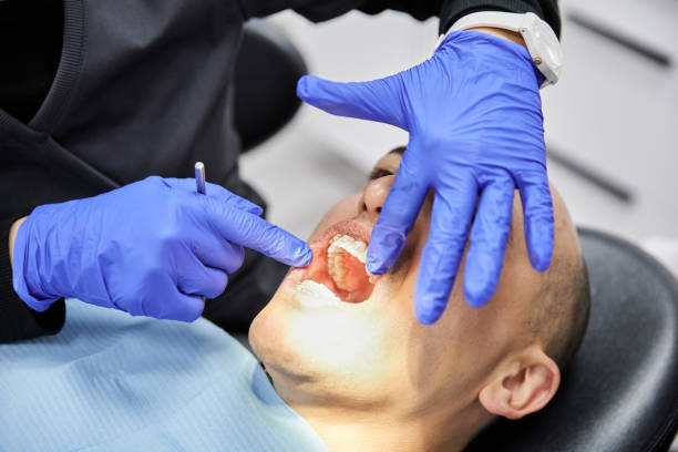 Best Emergency Dentist for Lost Fillings or Crowns in Skyline View, PA